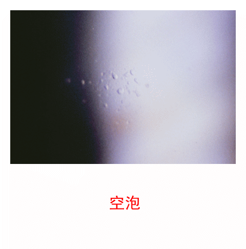 图集-缺氧和角膜水肿(软镜)-插图-2 图集-缺氧和角膜水肿(软镜)-插图-2