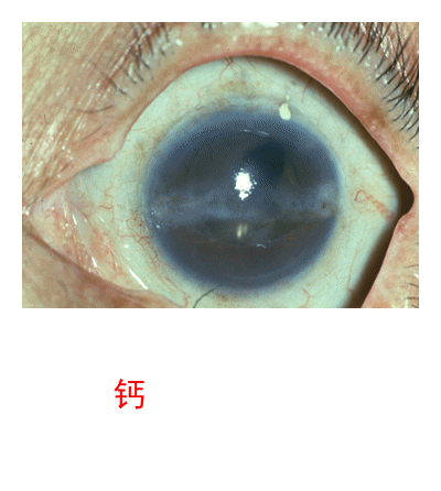3.2.5 眼睑病、角膜病诊断检查案例-4 眼睑病、角膜病诊断检查案例-图片集