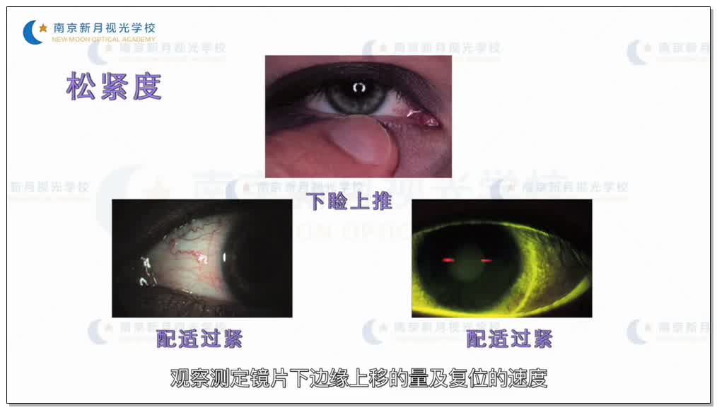 软性隐形眼镜配适评估-3隐形眼镜-验光师培训专题二