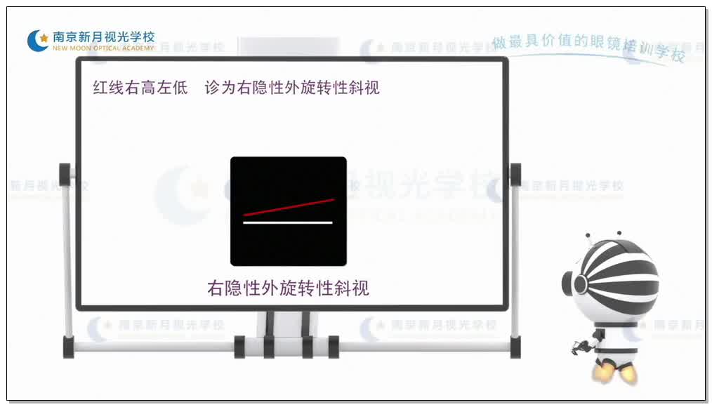 双马氏杆检测旋转性隐斜视-4视功能-验光师培训专题二