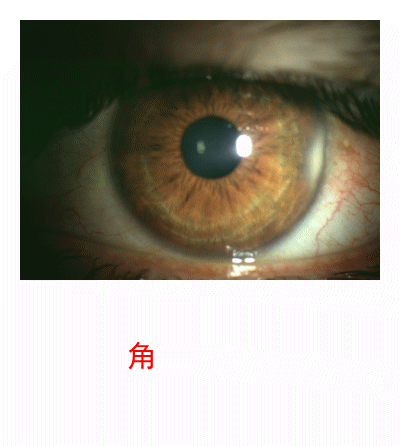 3.2.5 眼睑病、角膜病诊断检查案例-9 眼睑病、角膜病诊断检查案例-图片集