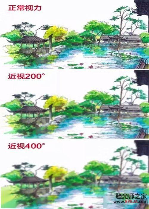 近视是病!一定得治!! 近视是病!一定得治!!