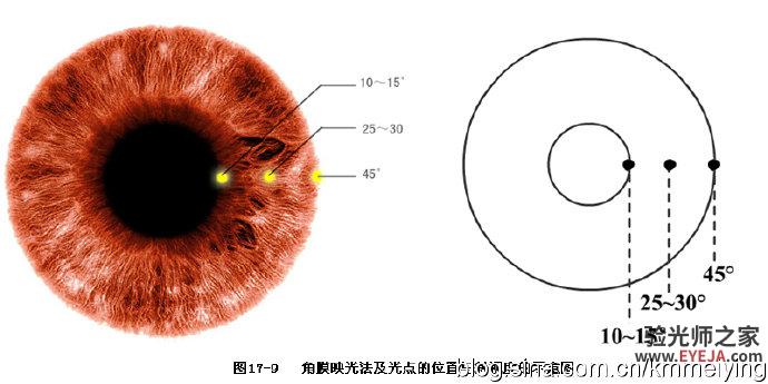 怎样检查眼位不正和分析结果(一)
