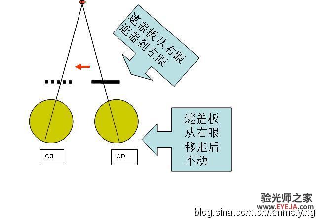 怎样检查眼位不正和分析结果(一) 怎样检查眼位不正和分析结果(一)