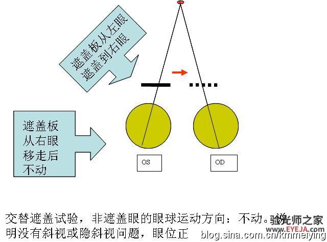 怎样检查眼位不正和分析结果(一) 怎样检查眼位不正和分析结果(一)