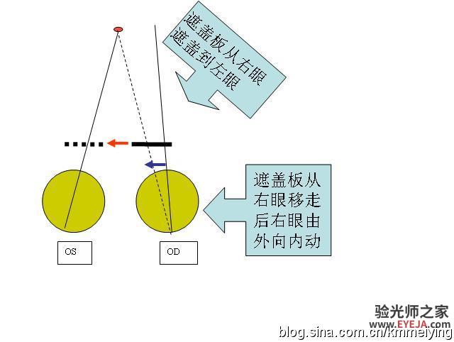 怎样检查眼位不正和分析结果(一) 怎样检查眼位不正和分析结果(一)