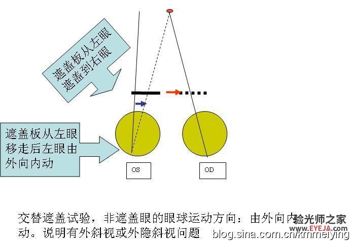 怎样检查眼位不正和分析结果(一) 怎样检查眼位不正和分析结果(一)