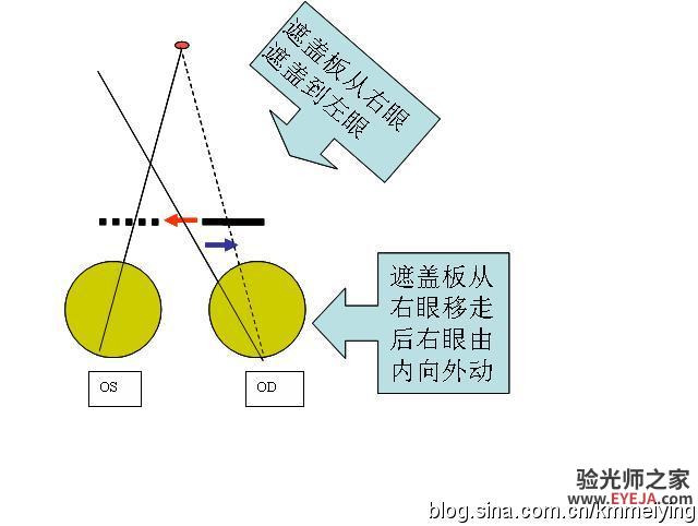 怎样检查眼位不正和分析结果(一) 怎样检查眼位不正和分析结果(一)