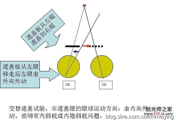 怎样检查眼位不正和分析结果(一) 怎样检查眼位不正和分析结果(一)