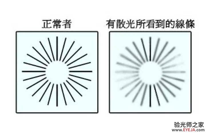 什么是散光,怎么看自己有没有散光? 什么是散光,怎么看自己有没有散光?