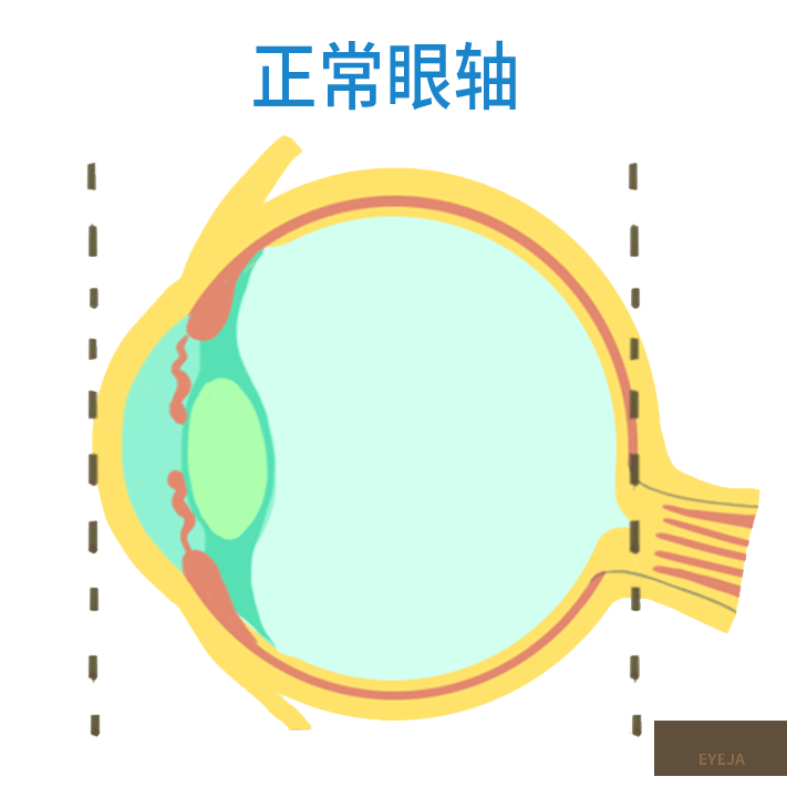 一文读懂|为啥要给孩子测眼轴? 一文读懂|为啥要给孩子测眼轴?