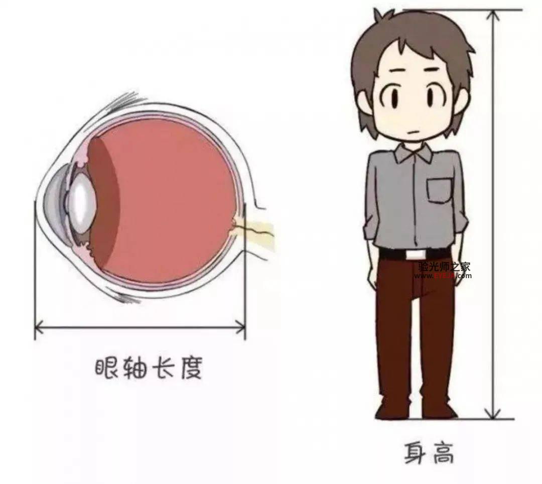 近视预警好方法:建立屈光发育档案 近视预警好方法:建立屈光发育档案