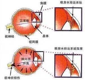 近视预警好方法:建立屈光发育档案 近视预警好方法:建立屈光发育档案