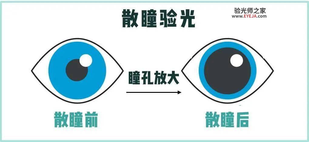 近视预警好方法:建立屈光发育档案 近视预警好方法:建立屈光发育档案