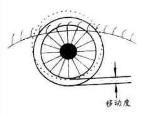 隐形眼镜配戴评估方法 隐形眼镜配戴评估方法