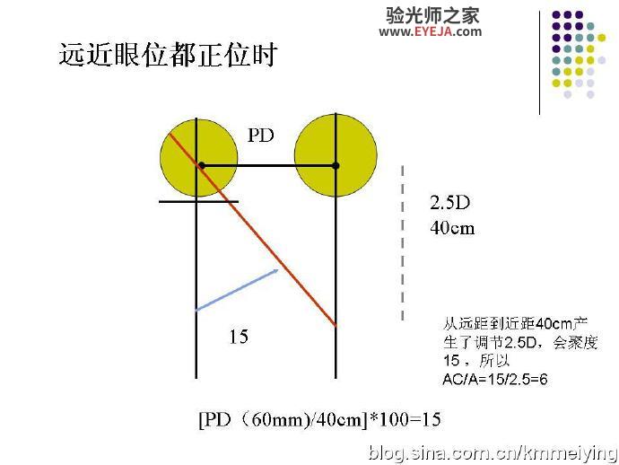 AC/A——调节性集合与调节的比率 AC/A——调节性集合与调节的比率