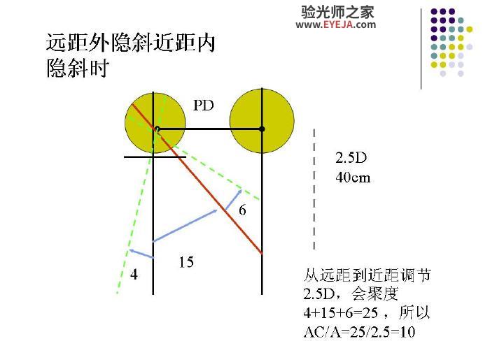 AC/A——调节性集合与调节的比率 AC/A——调节性集合与调节的比率