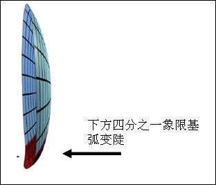 ACT技术验配下方圆锥案例分析 ACT技术验配下方圆锥案例分析