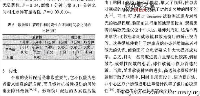 读书:《角膜散光与软性角膜接触镜配适评估的相关性分析》 读书:《角膜散光与软性角膜接触镜配适评估的相关性分析》