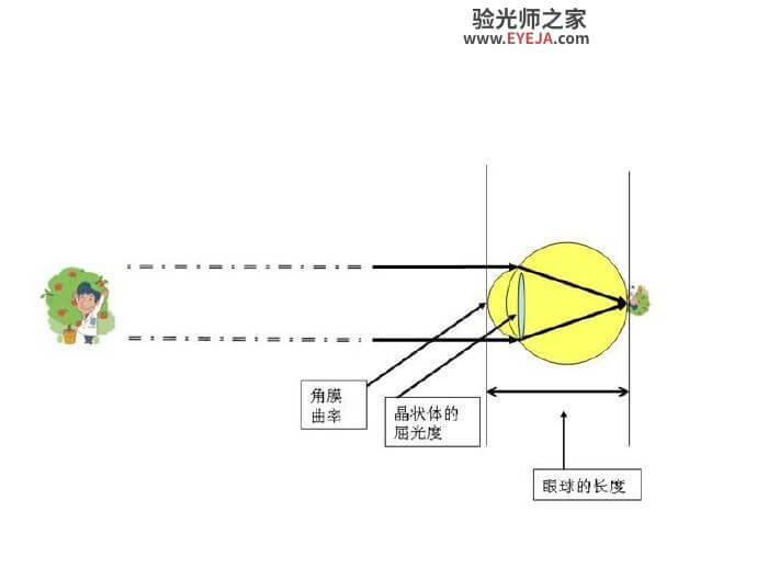 再说说为什么儿童验光要扩瞳? 再说说为什么儿童验光要扩瞳?