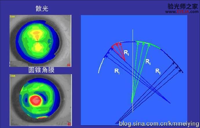 再说说几种常用的角膜地形图类型 再说说几种常用的角膜地形图类型
