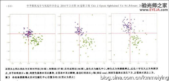 读书《圆锥角膜患者角膜地形图形态学特征》 读书《圆锥角膜患者角膜地形图形态学特征》