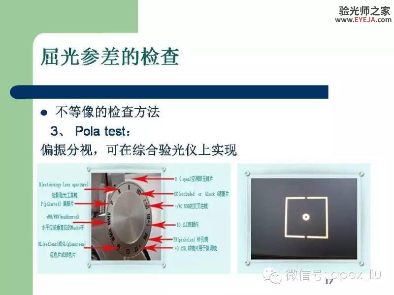 转载:尖峰眼科课程分享---屈光参差 转载:尖峰眼科课程分享---屈光参差