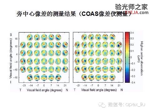 推荐阅读(转载):尖峰眼科课程分享之近视眼发病机理研究 推荐阅读(转载):尖峰眼科课程分享之近视眼发病机理研究