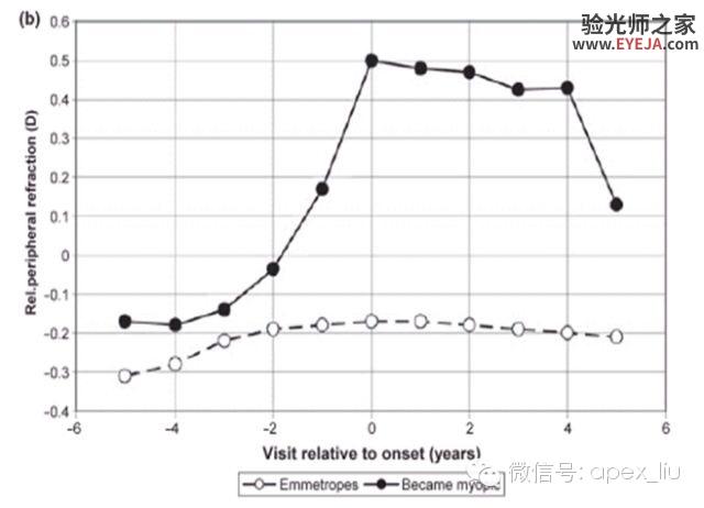 推荐阅读(转载):尖峰眼科课程分享之近视眼发病机理研究 推荐阅读(转载):尖峰眼科课程分享之近视眼发病机理研究