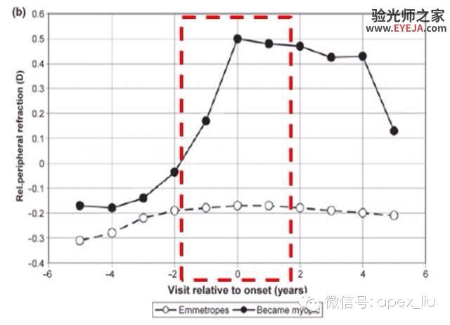 推荐阅读(转载):尖峰眼科课程分享之近视眼发病机理研究 推荐阅读(转载):尖峰眼科课程分享之近视眼发病机理研究