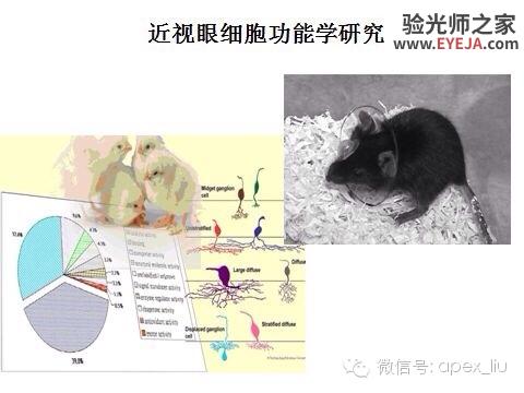推荐阅读(转载):尖峰眼科课程分享之近视眼发病机理研究 推荐阅读(转载):尖峰眼科课程分享之近视眼发病机理研究