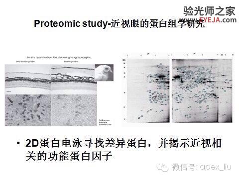 推荐阅读(转载):尖峰眼科课程分享之近视眼发病机理研究 推荐阅读(转载):尖峰眼科课程分享之近视眼发病机理研究