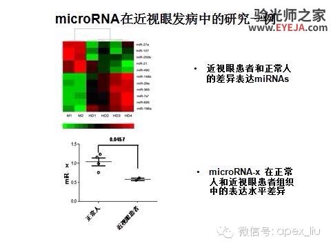 推荐阅读(转载):尖峰眼科课程分享之近视眼发病机理研究 推荐阅读(转载):尖峰眼科课程分享之近视眼发病机理研究