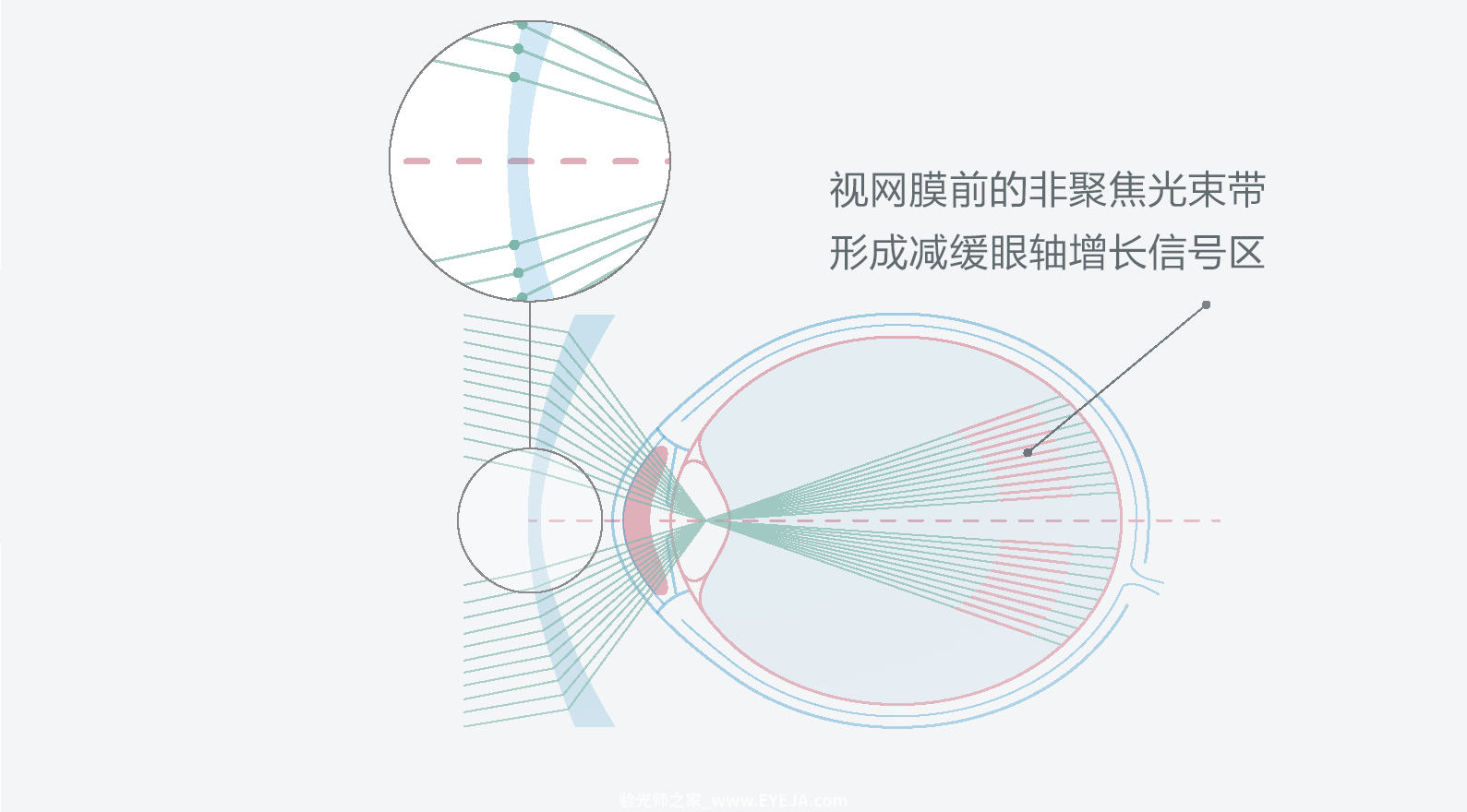 依视路-星趣控 镜片介绍 依视路-星趣控 镜片介绍