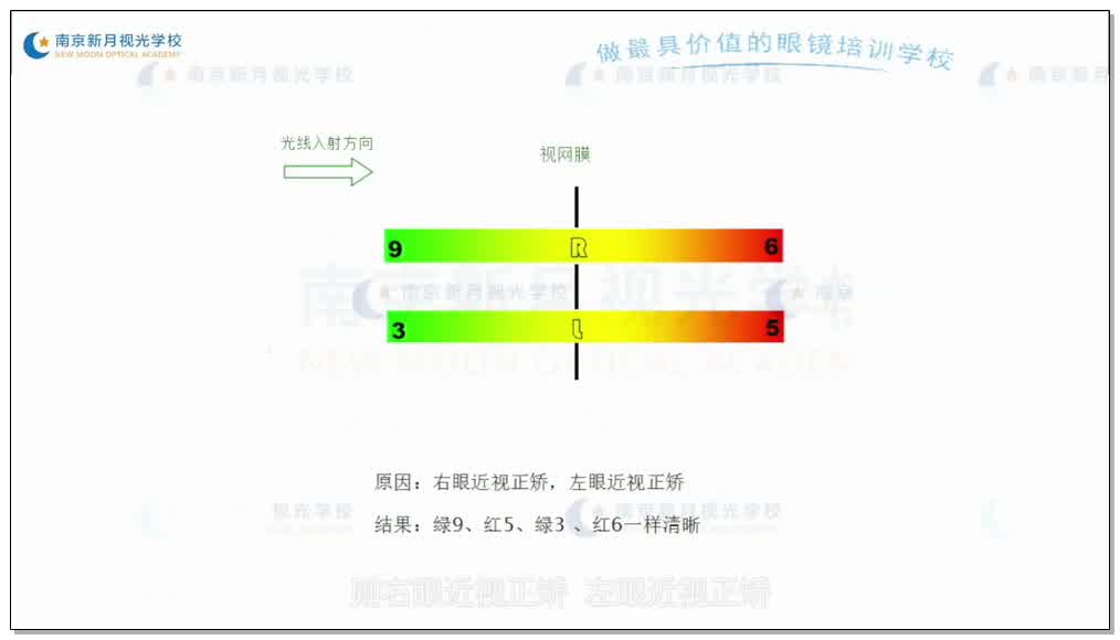 双眼屈光平衡检测方法 偏振红绿视标法-4视功能-验光师培训专题二
