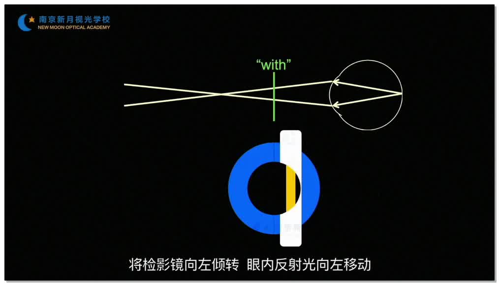 球镜的检影验光-1验光基础知识和流程-验光师培训专题二
