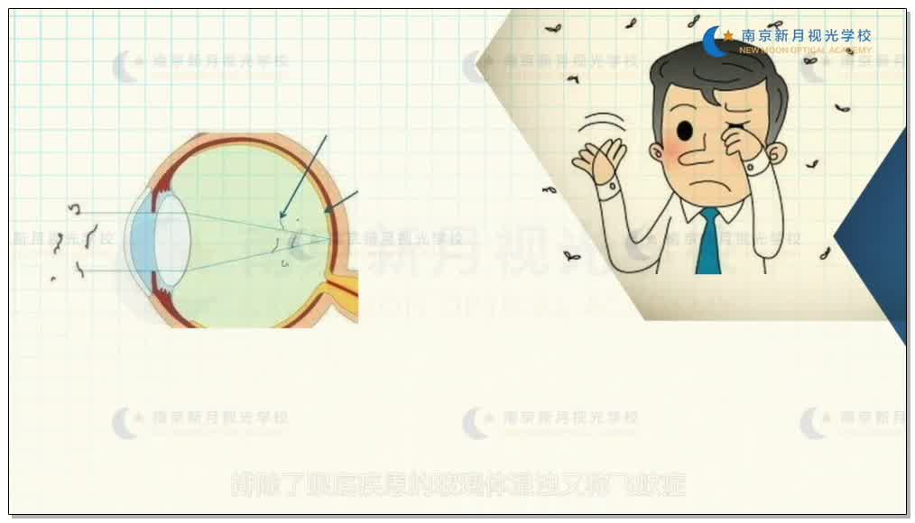 和视力相关的常见眼病视频-2眼科学和眼镜基础-验光师培训专题二
