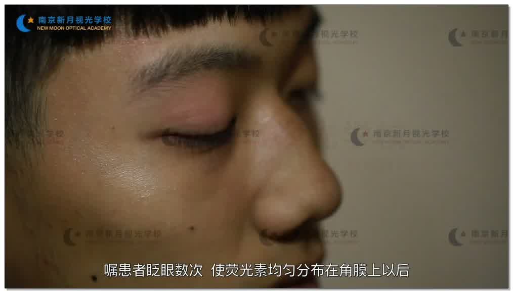 泪液破裂时间测定-3隐形眼镜-验光师培训专题二