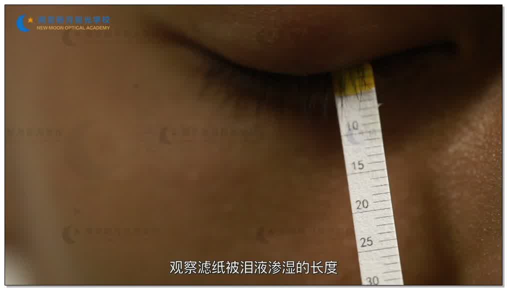 泪液分泌量测试-3隐形眼镜-验光师培训专题二