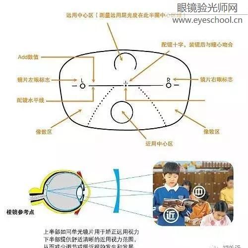 从离焦镜片 对比 单焦点镜片 来谈预防近视!