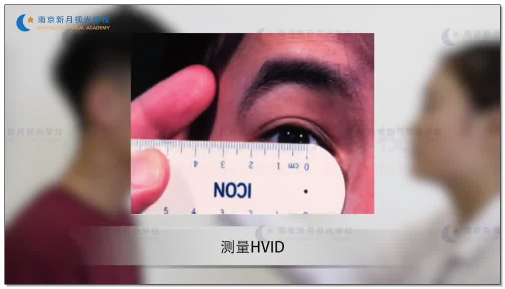 软性角膜接触镜验配流程-3隐形眼镜-验光师培训专题二