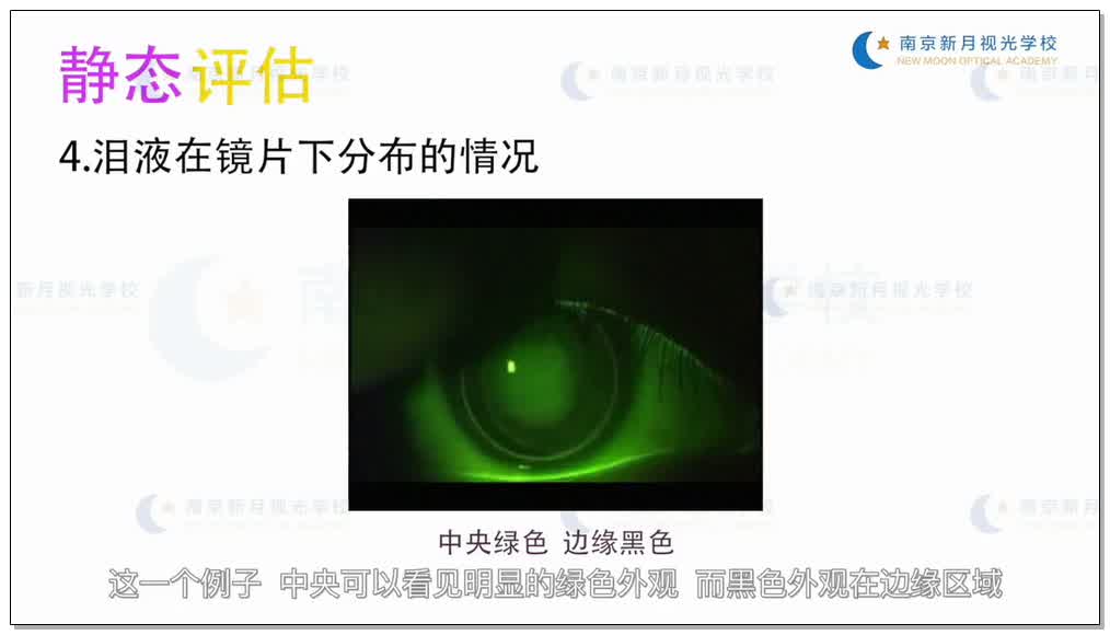 验配球性RGP镜片-3隐形眼镜-验光师培训专题二