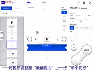 蔡司SRU-远距负融像聚散检查-界面说明与操作演示-蔡司培训视频-插图-