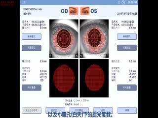 蔡司光优视分析-4个图形-蔡司培训视频
