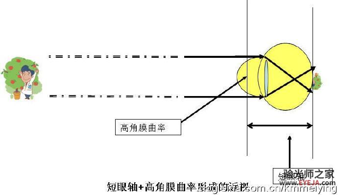 屈光发育档案的检查结果怎么看？怎么分析和处理？