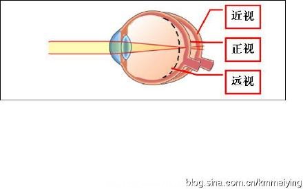 为什么说适龄儿童不论视力好坏都应该验光！