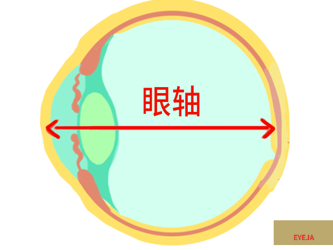 一文读懂|为啥要给孩子测眼轴？