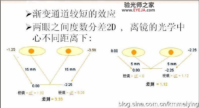 屈光参差验配渐变镜案例一例