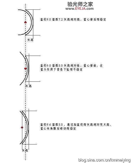再说说RGP直径的选择