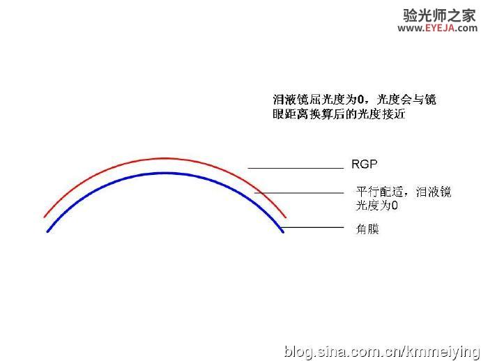 从RGP光度看配适案例